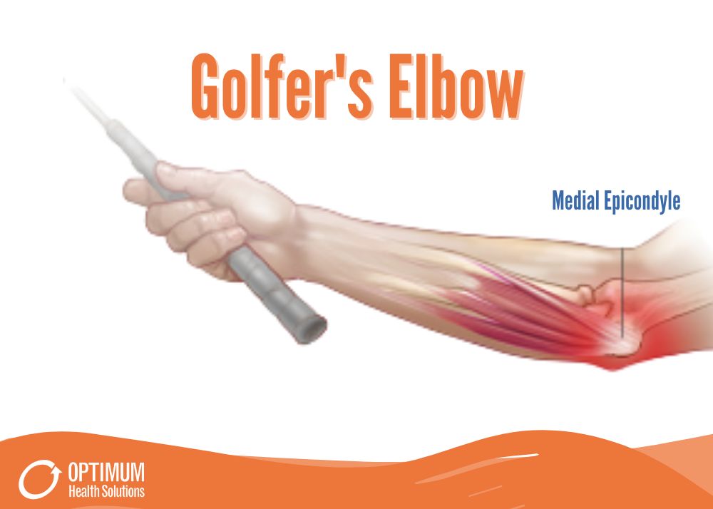 What is Golfer's Elbow?